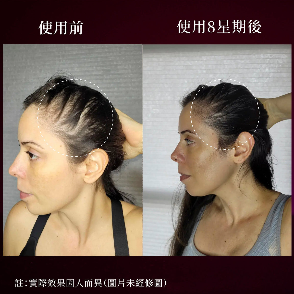 Nail n Mane - 阿育吠陀補充劑，助你擁有健康、強韌同亮麗嘅頭髮與指甲 Supplements Ayuttva